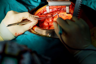 Cropped hands of doctor doing surgery on patient at operating room