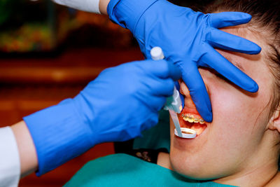 Cropped hands of dentist examining patient