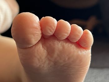 human leg