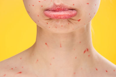 Close-up of woman with chickenpox against yellow background