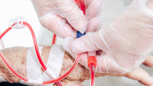 Cropped hand of nurse treating patient in hospital