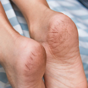 Close-up of human hand