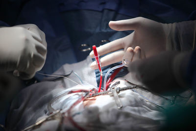 Cropped hands of surgeons doing surgery on patient at hospital