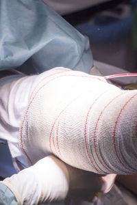 High angle view of doctor applying bandage on patient