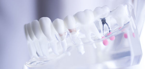 Close-up of dental equipment