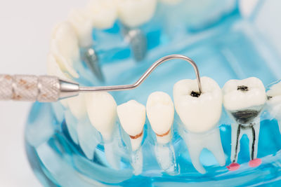 Close-up of dentures and medical equipment