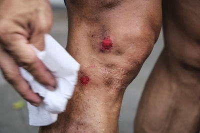 Cropped image of man cleaning wounds on knee