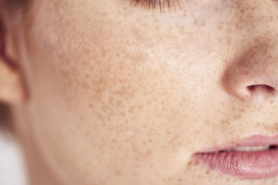 Cropped image of woman with freckles on face