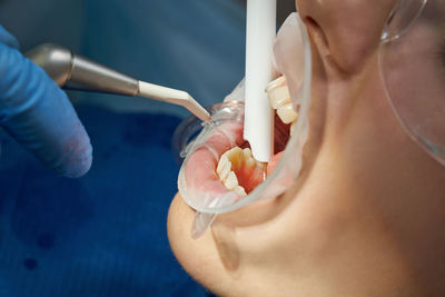 Woman getting dental treatment