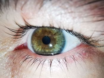 eye