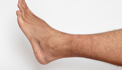 arm