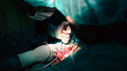 Doctors performing an appendectomy surgery, surgical concept