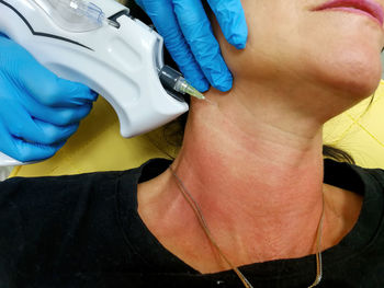 Neck rejuvenation with carbon dioxide, carboxytherapy, getting rid of wrinkles and a second chin 