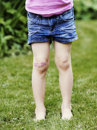 Girl with band-aid on her knee, low section