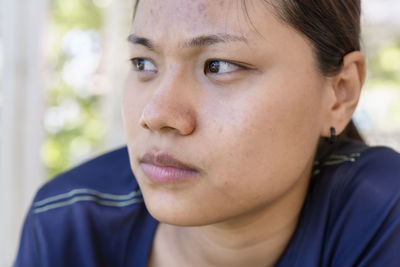 Young asian woman worry about her face when she has problems with skin on her face in nature.