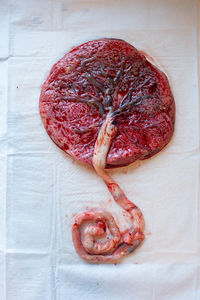 Human placenta with veins and umbilical cord visible.