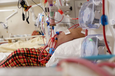 The patient is in a hemodialysis session.hemodialysis session person