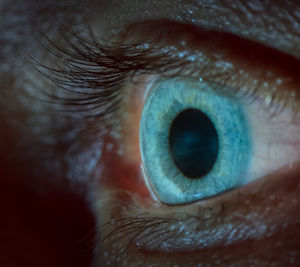 Close-up of human eye