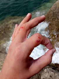 Close-up of woman hand with bruises over stream