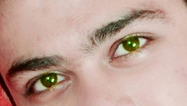human eye