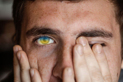 The young european brunet guy covered his face with his hands. flag in eyes. tired and desperate 