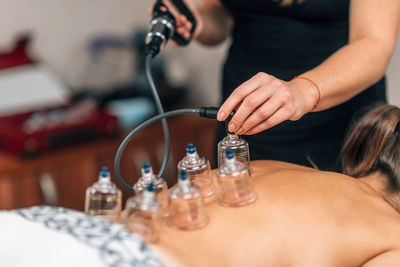 Vacuum therapy. therapist placing transparent glass cups on woman's back