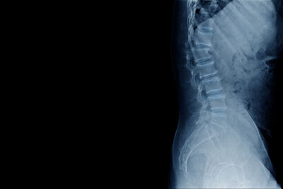 Full frame shot of x-ray