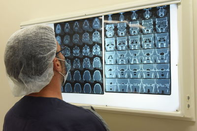 A surgeon see a x-ray image before craneal surgery