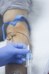 Cropped image of surgeon removing blood from patient arm in hospital