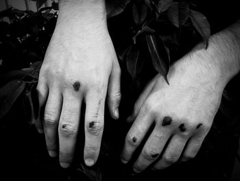 High angle view of person hands with wounds on plants
