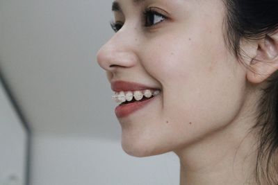 Close-up of smiling woman with braces