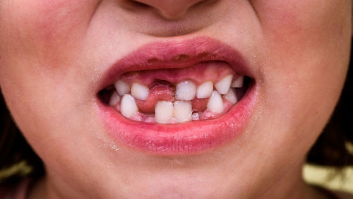 Midsection of girl with gap tooth