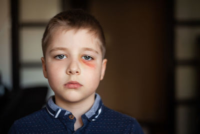 A boy with a bruised eye after a fight or violence