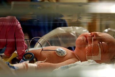 Newborn in hospital incubator. 