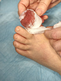 Mother treats a child's ingrown toenail. injury during playing game. home treatment. bloody hurt toe