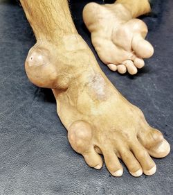 human leg