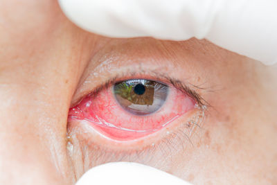 Close-up of human eye