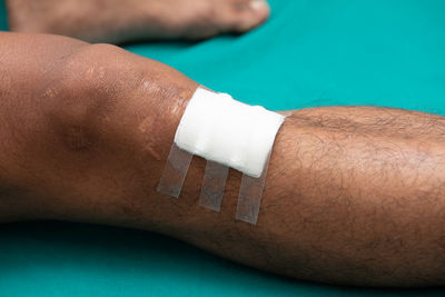 Close-up of man leg with cotton bandage on knee