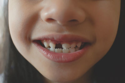 Little girl losing his first tooth