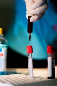 Midsection of doctor examining blood sample in test tube