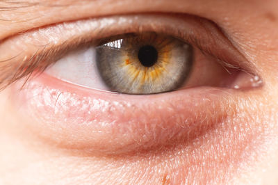 Close-up of a male frightened human eye in grey-green red color