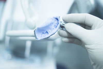 Close-up of hand holding dental mold