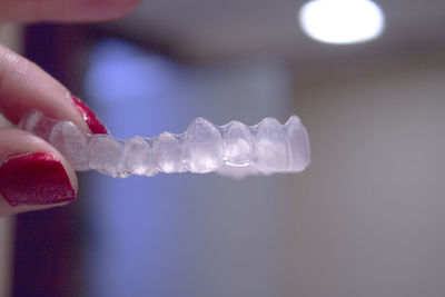 Cropped hand of woman holding dental aligner