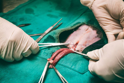 Cropped hands of surgeons operating patient