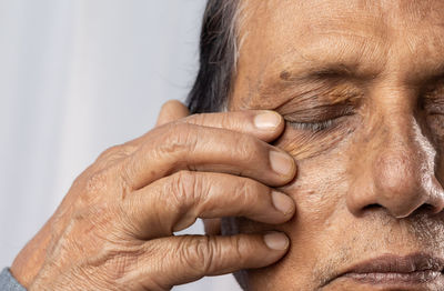 Close up of white bags an wrinkles around eye of an indian old man on white background