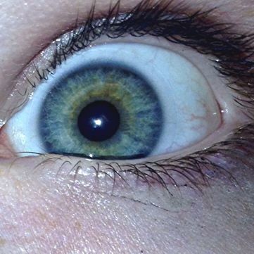 My eye.(: