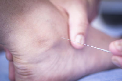 Close-up of doctor injecting syringe in patient foot in operating room