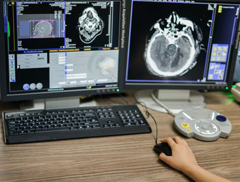 Cropped hand of doctor using computer at table in hospital