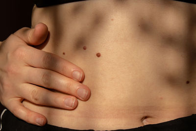 Birthmarks on skin close up detail of the bare skin sun exposure effect on skin, health effects of