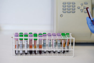Assorted blood sample tubes on table near crop anonymous medical technologist with professional hematology equipment during diagnostic process in laboratory